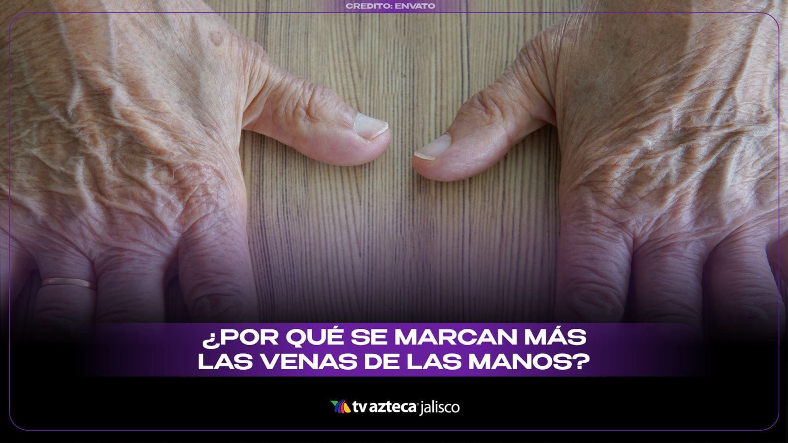 Por qué se marcan las venas de las manos