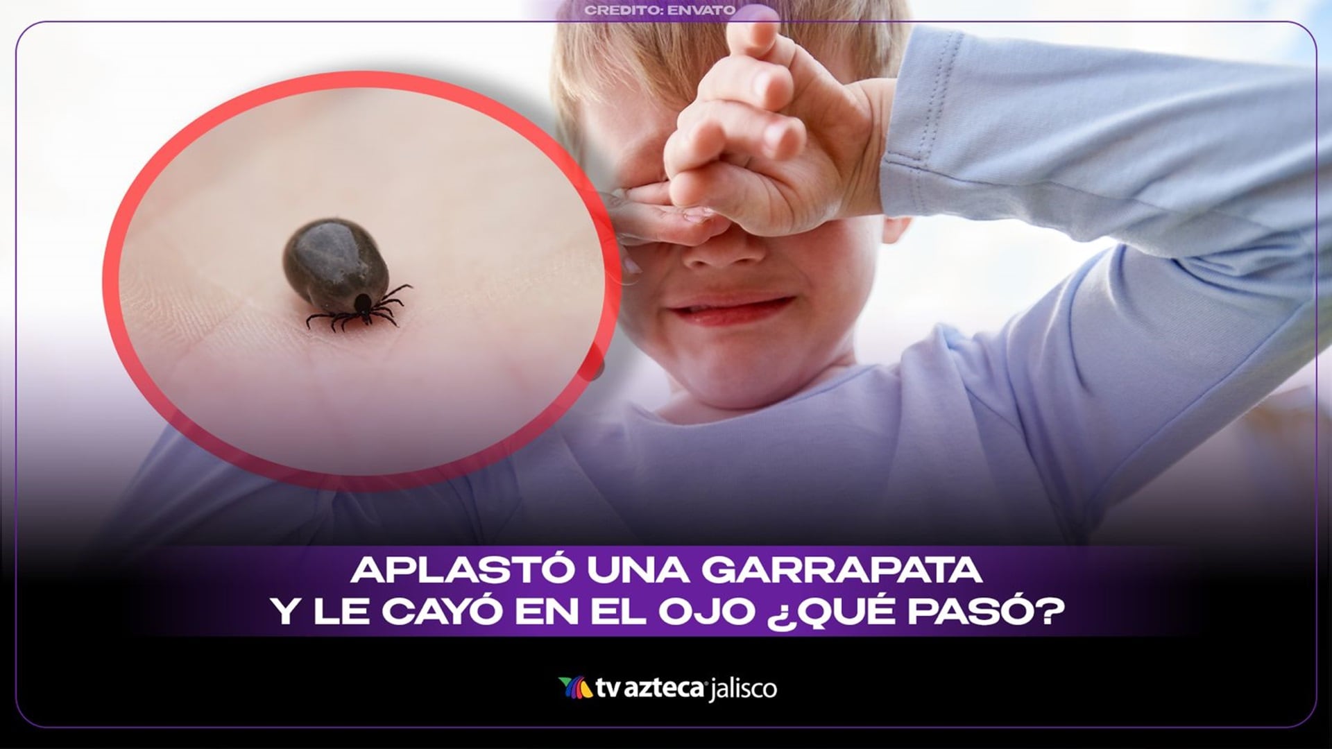 Dylan murió tras manipular una garrapata; expertos explican cómo retirarlas sin riesgos