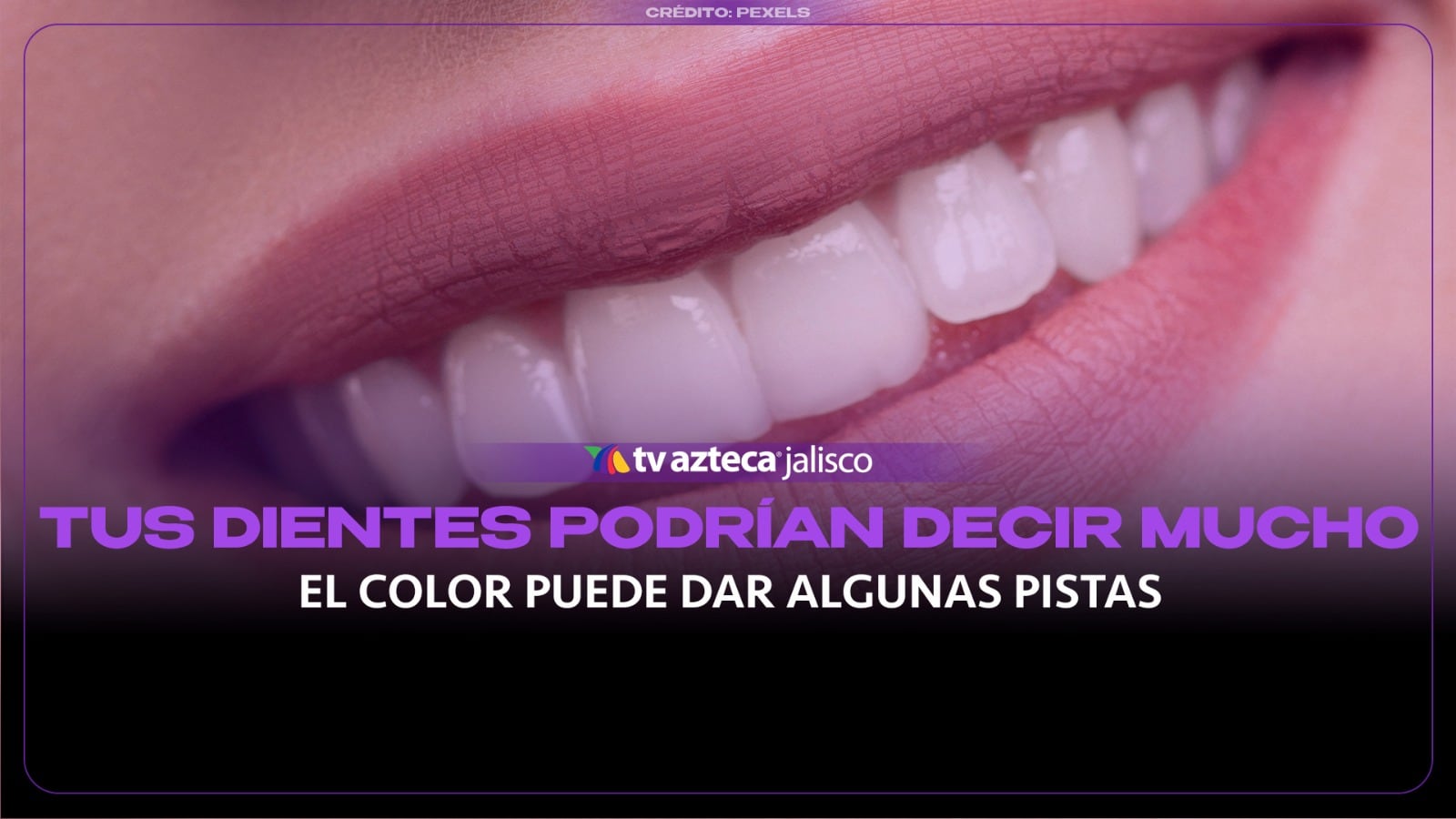 ¿De qué color son tus dientes? Estos cambios pueden revelar señales sobre tu salud bucal