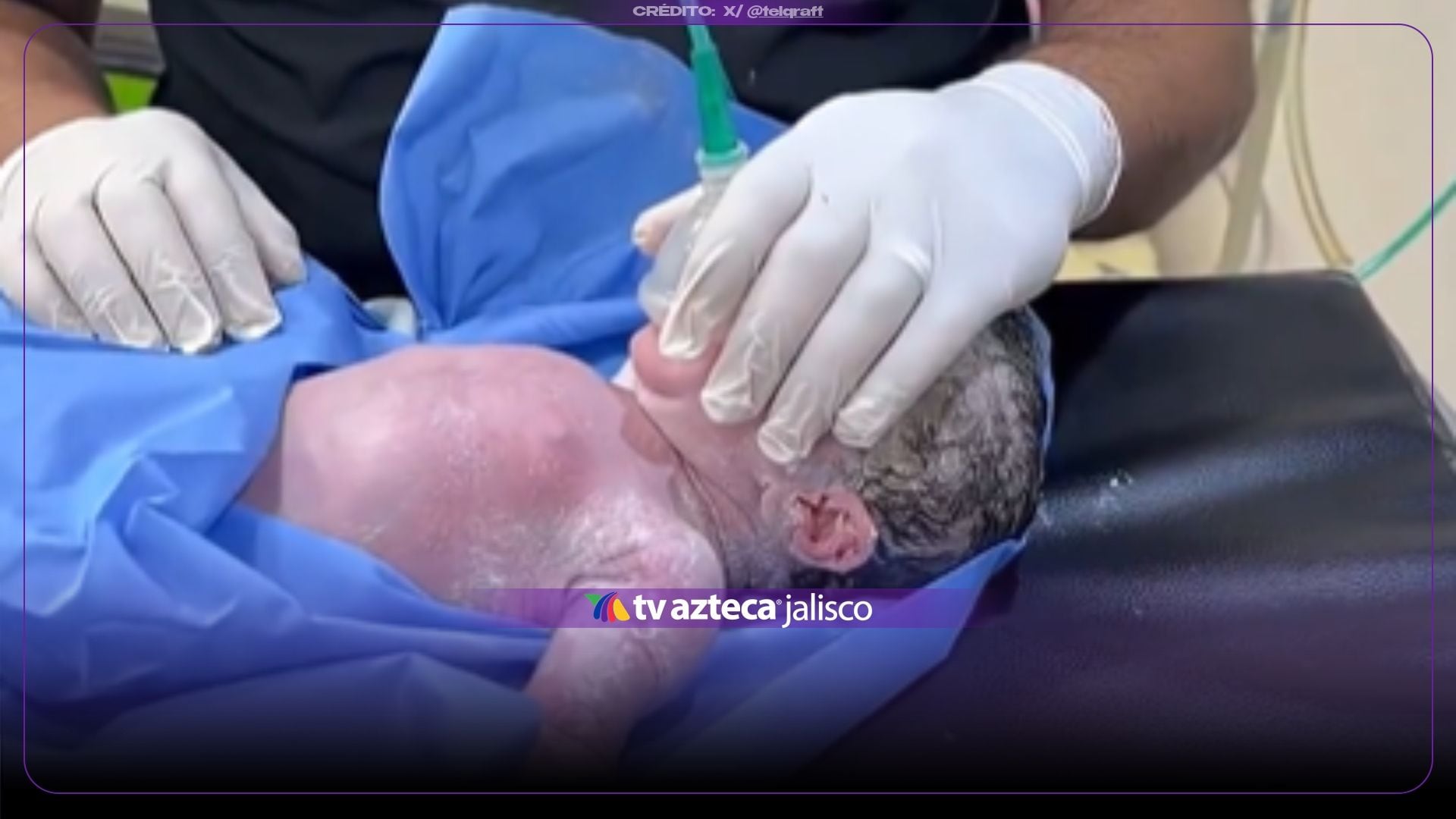 IMPRESIONANTE VIDEO: ¡Milagro en la sala de partos! Médico lucha por salvar a un bebé y logra que vuelva a respirar