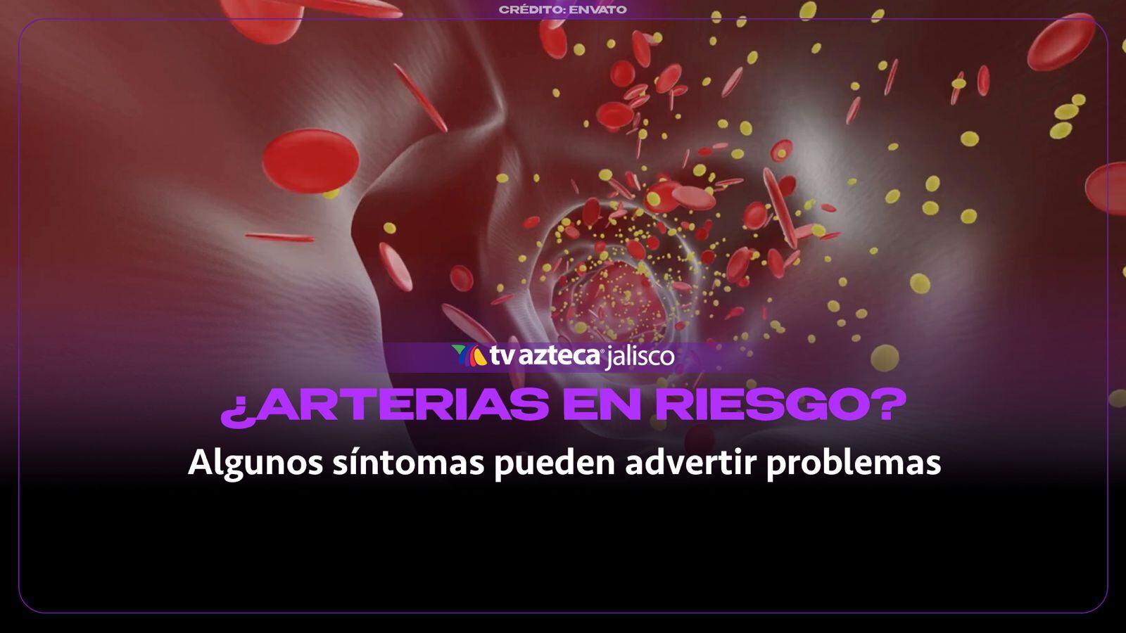 Señales de arterias obstruidas que no debes ignorar