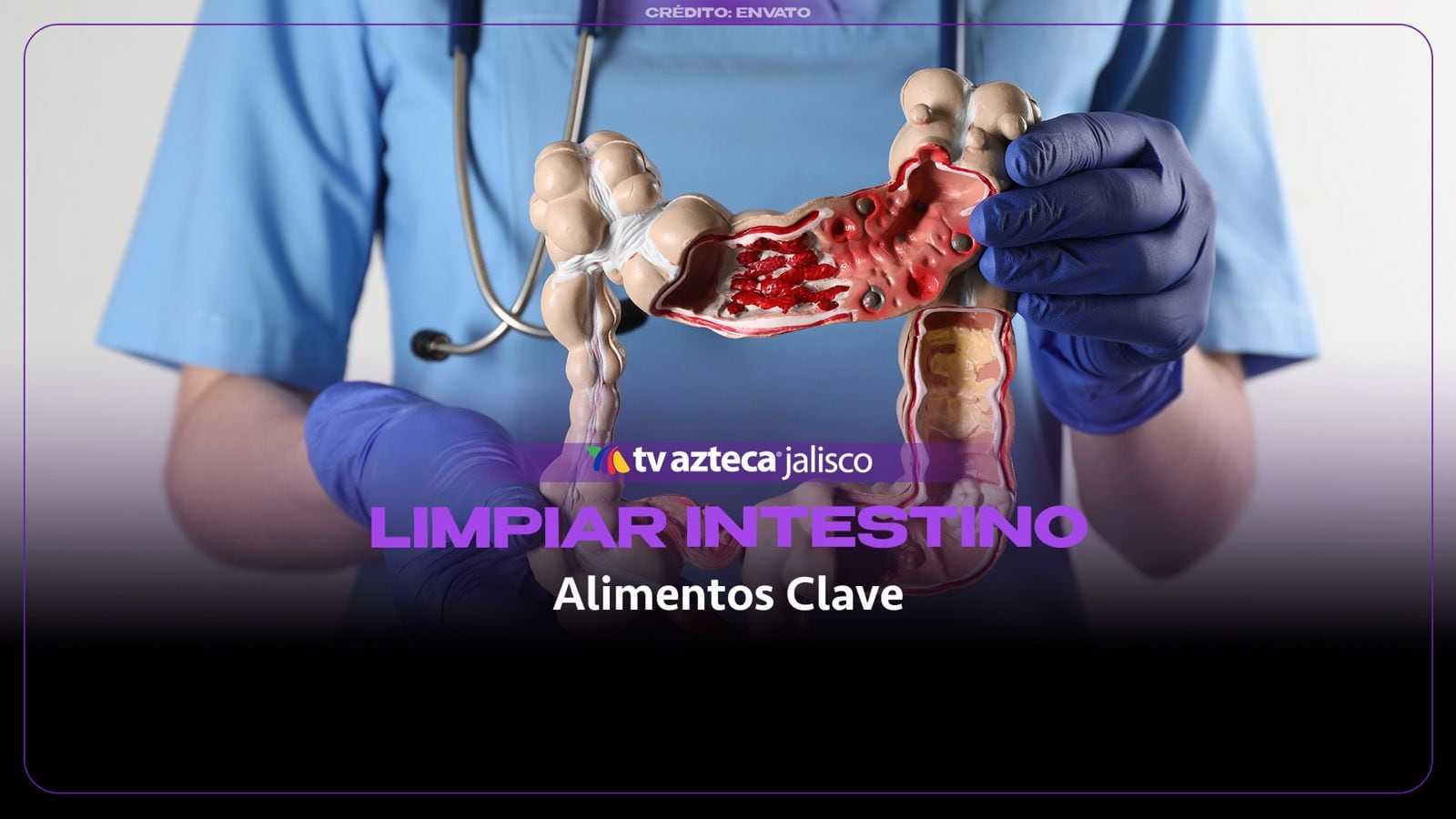 Alimentos esenciales para limpiar el intestino y mejorar tu bienestar digestivo