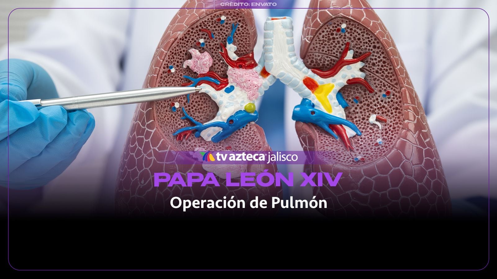 Papa León XIV retoma sus actividades tras cirugía por cáncer de pulmón; ¿cómo evoluciona su salud?